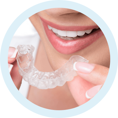 img invisalign anwendung step 1